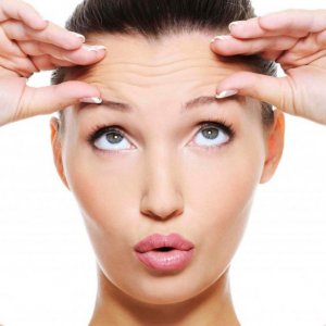 Alın Çizgileri Tedavisi